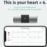 Revolutionizing Heart Health: Unveiling the Power of KardiaMobile 6-Lead for Unmatched ECG Precision